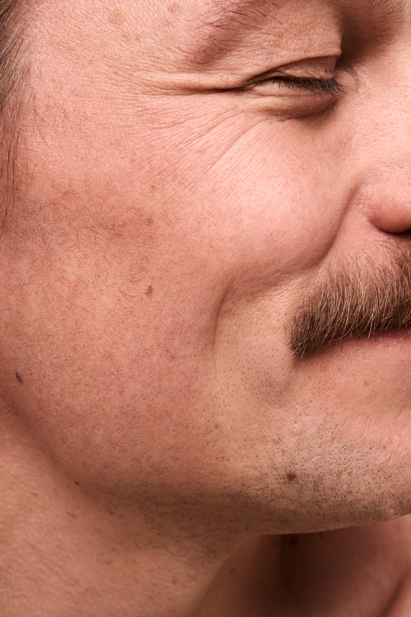 Sebum regulation