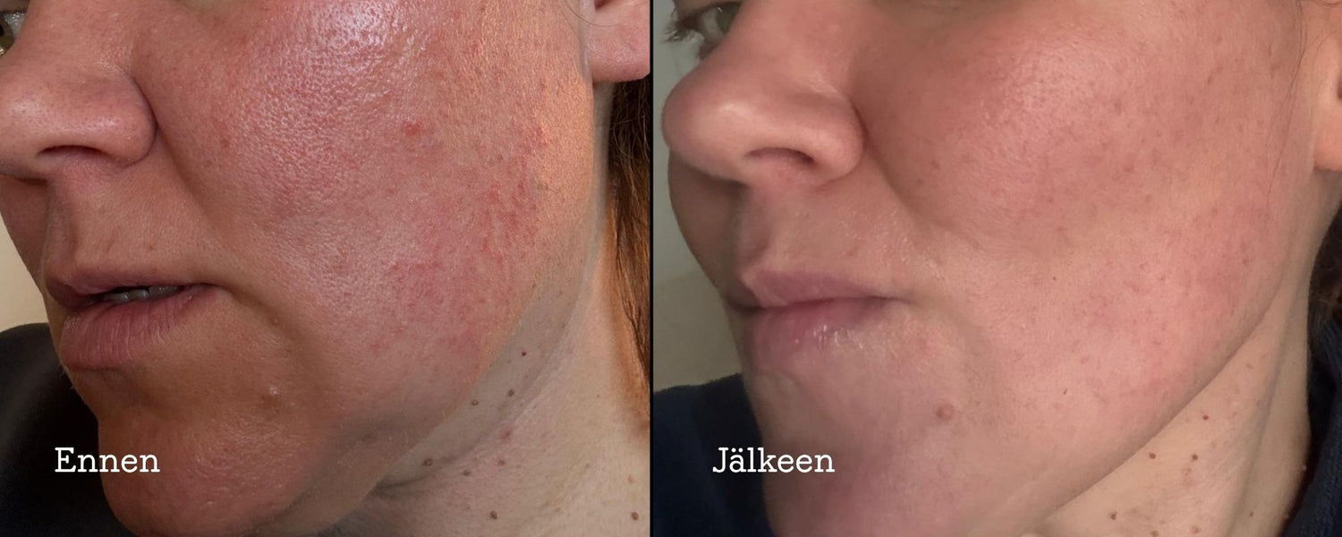 Neo - 20% CBD-oil Booster 10ml